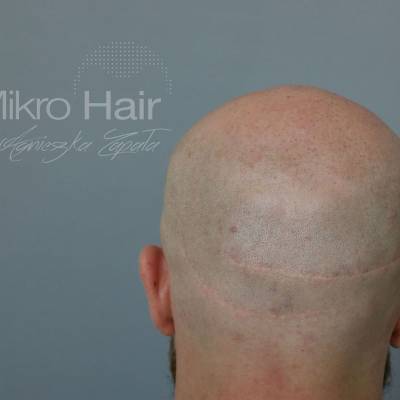 Mikro Hair